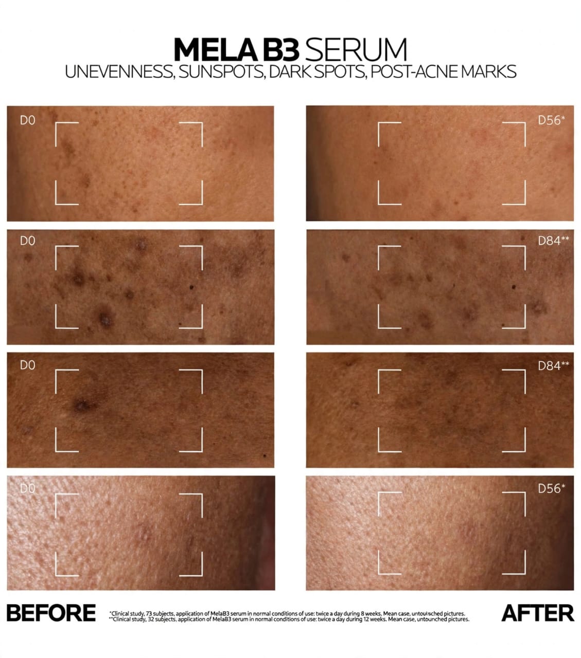 La Roche-Posay Mela B3 Serum – سيروم لتفتيح وتصحيح البقع الداكنة